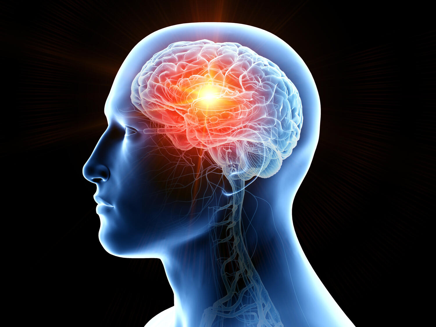 dementia brain