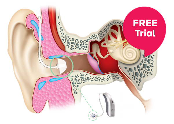 Ear anatomy with FREE Trial bubble