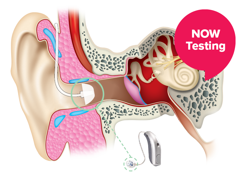 Now Testing, ear diagram with hearing aid 2.5cm in height
