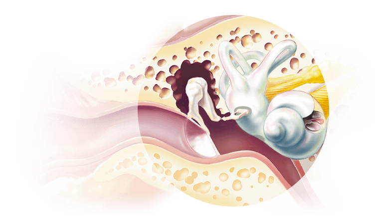 age related hearing loss hearinglife canada age related hearing loss hearinglife canada