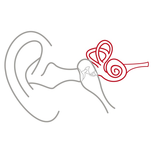 Illustration de l'oreille externe, de l'oreille moyenne et de l'oreille interne, l'oreille interne étant surlignée en rouge.