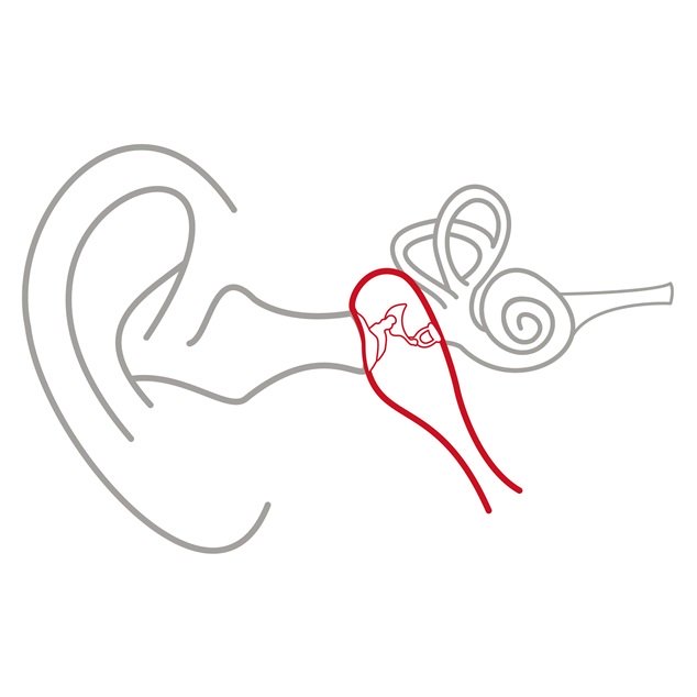 Illustration of the outer ear, middle ear, and inner ear with the middle ear highlighted in red