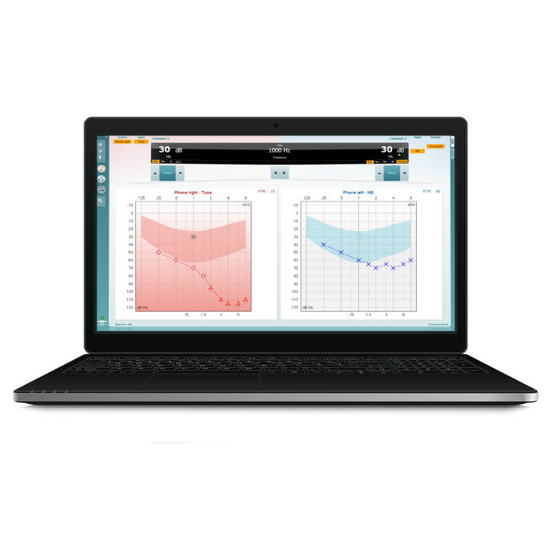 Interacoustics Interacoustics AC40