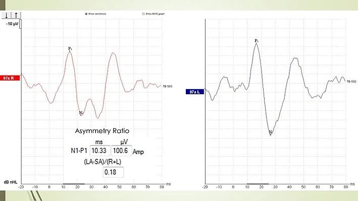 cvemp-with-asymmetry-ratio