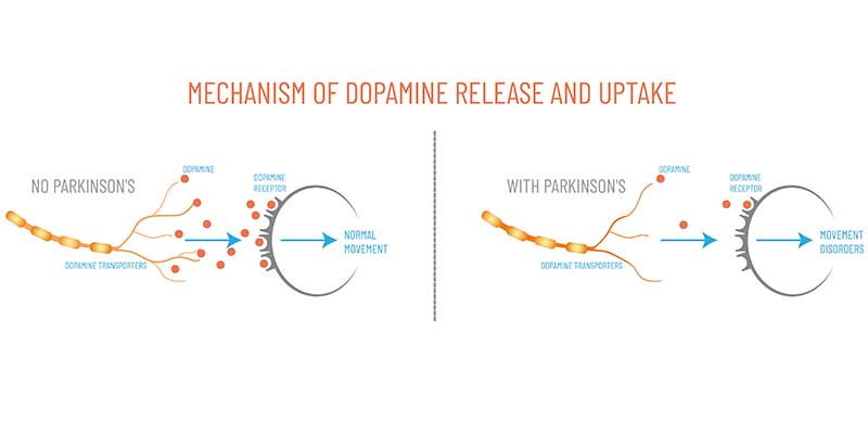 Parkinson's disease dopamine