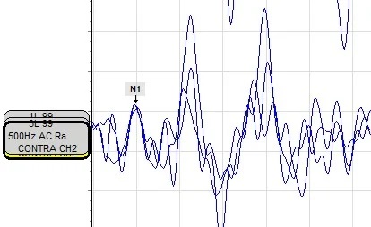 ovemp-reading-1
