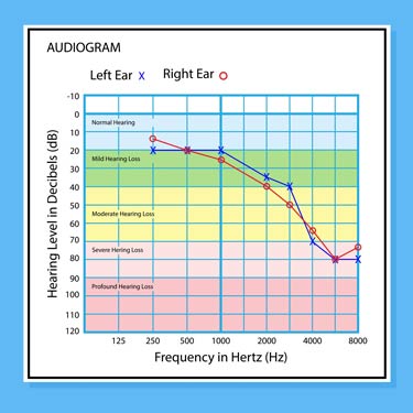 audiogram-example