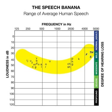 the-speech-banana