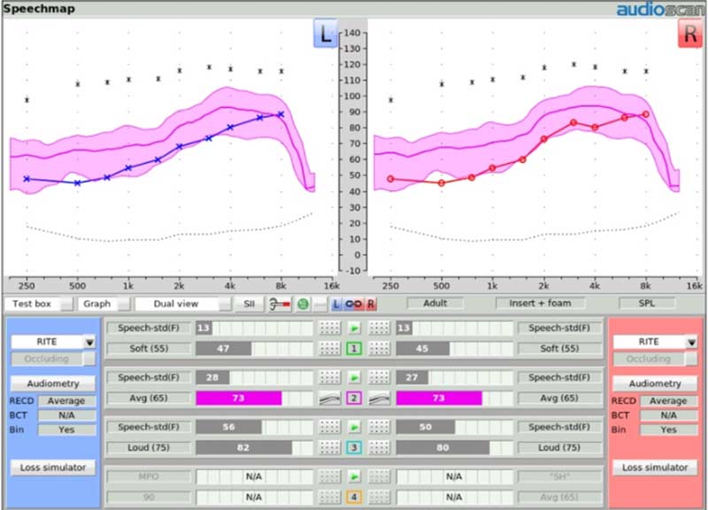 Speech Intelligibility Index displayed on the Audioscan Verifit2 speechmap