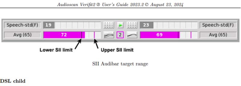 Speech Intelligibility Index range displayed on the Audioscan Verifit2