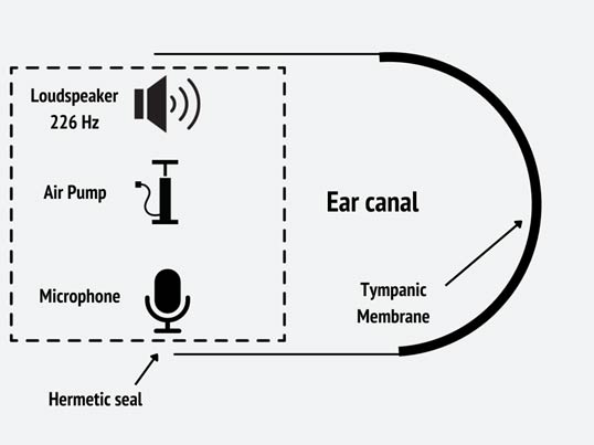 tympanometer Figure 8