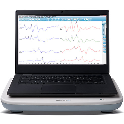 Oae Oae Hearing Screeners E3 Diagnostics