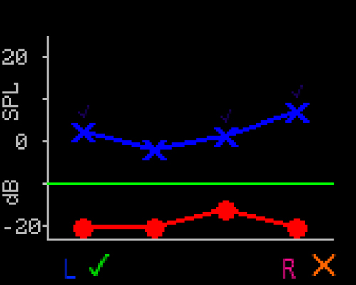 RL Value graph with a pass and refer result