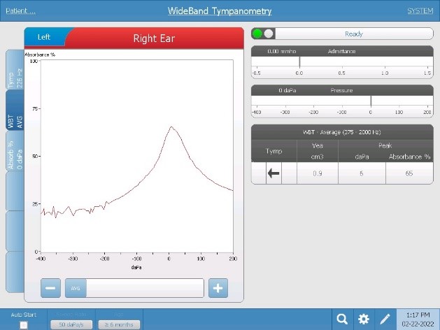WideBand Example Tracings | GSI Blog