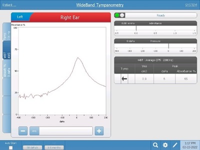 WideBand Example Tracings | GSI Blog