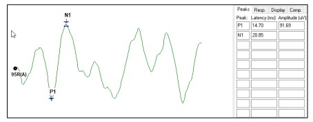 cVEMP Waveform Graph
