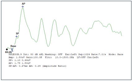 ecochg-sp-ap-ratio-1
