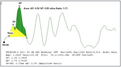ecochg-sp-ap-ratio-2