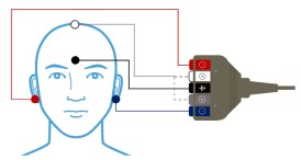 mmn-electrode-placement