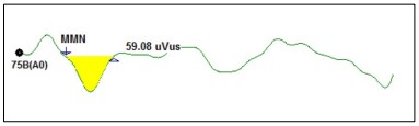 mmn-graph