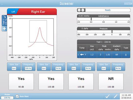 Screening Tympanometry Testing Screen