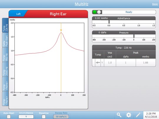 Multi-Hz Tympanometry Test Screen