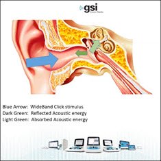 whats-the-hype-about-wideband-tympanometry