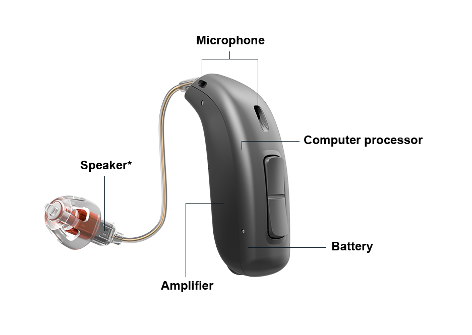 text-image-spot---a-look-inside-a-hearing-aid-936x665