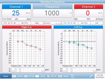 Pello Standard Audiometry Testing Screen